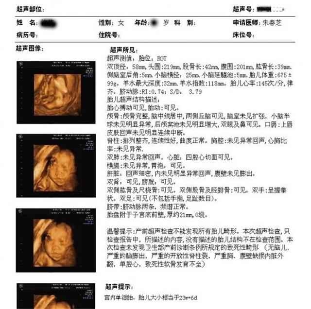 五个月彩超女孩准吗，科学、技术与伦理的探讨