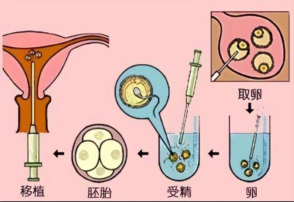 试管婴儿三个月后，希望与挑战并存的旅程